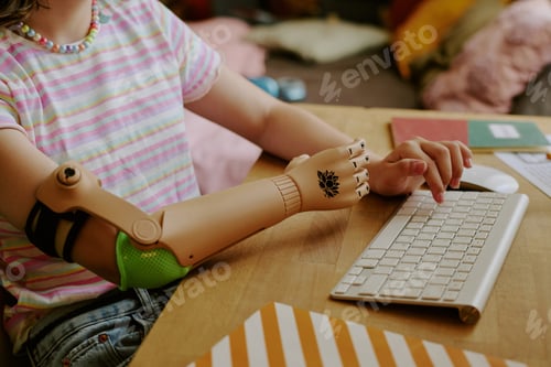 Preview: Unrecognizable Girl With Disability Typing On Keyboard