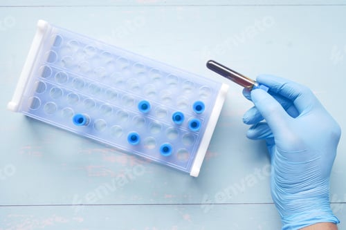 Preview: hand in blue medical gloves holding blood test tube