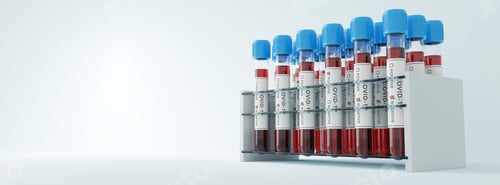 Preview: Coronavirus Covid19 test tubes in a rack. Medical screening and Covid tests production