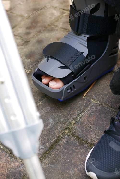 Preview: women broken feet with a grey plastic boot ankle brace injury protecting boot
