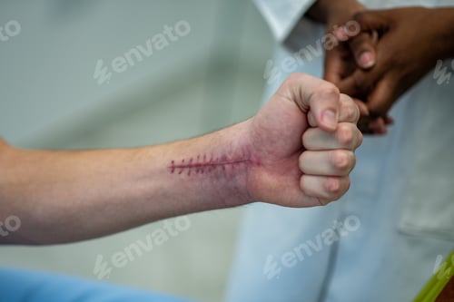 Preview: Scars on the skin of the man arm after surgery