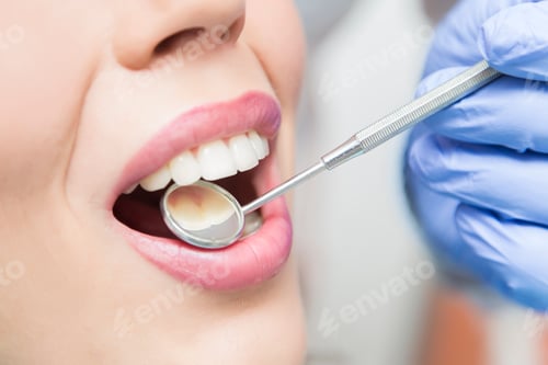 Preview: Dental checkup