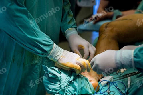 Preview: Orthopedic surgeons are skilled in performing operations on the leg to treat various injuries.