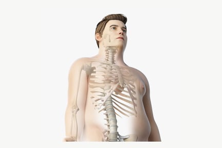 Preview: Overweight Male: Skin & Skeletal Anatomy