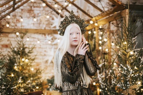 Preview: Albino girl