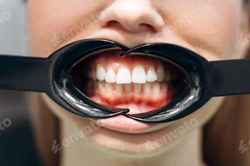 Preview: Close-up view, wide open teeth of the patient.