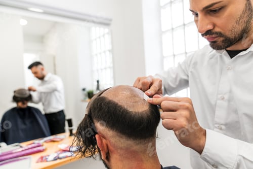 Preview: Hairdresser applying hair prosthesis to balding man in hair clinic