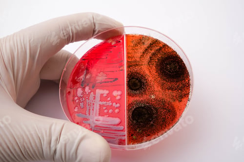 Preview: Gloved hand holding a petri dish with bacterial and fungal cultures on a red agar medium
