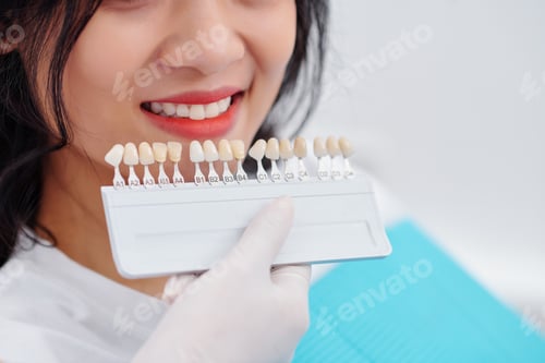 Preview: Dentist using teeth color palette