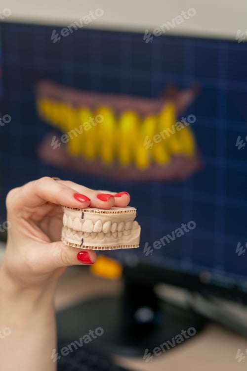 Preview: close-up professional laboratory for the production of dental prosthesis veneers woman against the