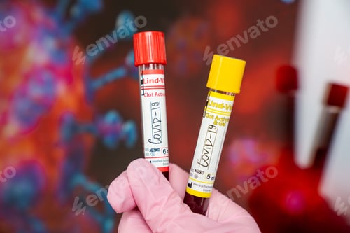 Preview: Covid-19 test samples in the hands of a doctor