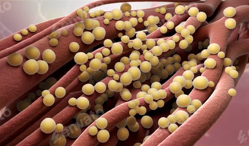 Preview: Staphylococcus aureus