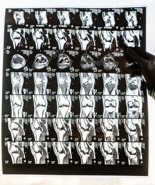 Preview: Magnetic resonance imaging of human knee joint for medical diagnosis