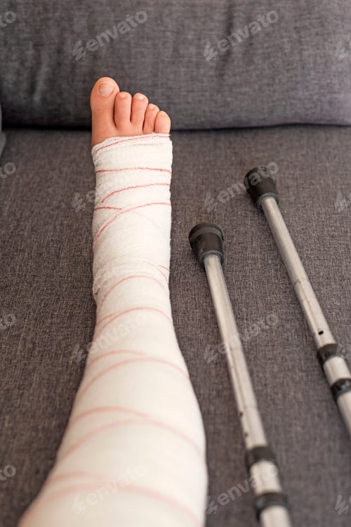 Preview: leg in bandage and crutches