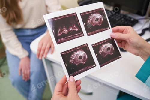 Preview: Focused photo on female hands holding ultrasound picture