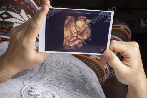 Preview: Young mother holding an unborn baby sonography 4D image and resting on a sofa