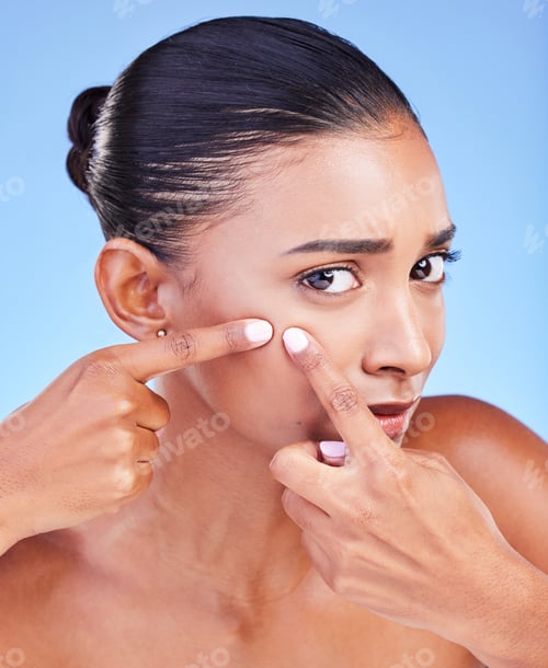 Preview: Acne, problem and portrait of woman with pimple in studio for cosmetic, mistake or disaster on blue