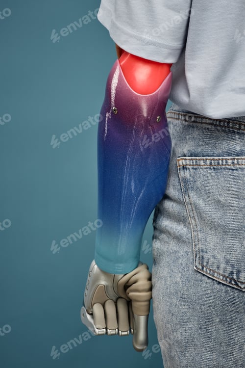 Preview: Prosthetic Hand Clenching Fist