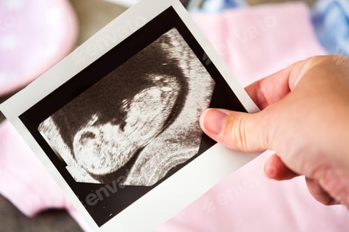 Preview: Pregnant woman holding ultrasound scan photo of baby