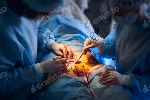 Preview: Surgeons Perform Delicate Operation in Operating Room