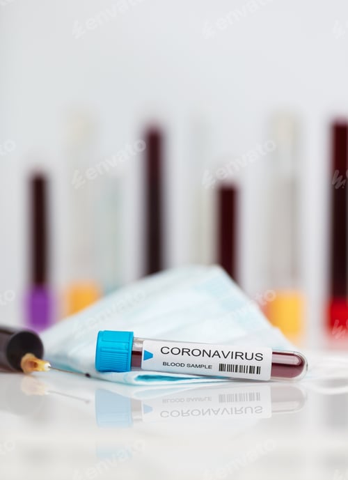 Preview: Laboratory sample of the novel Coronavirus