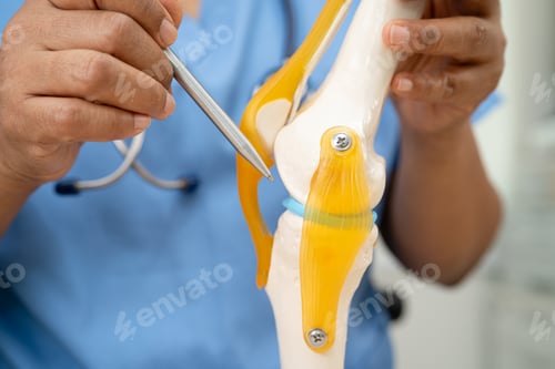 Preview: Osteoarthritis of the knee, Doctor holding human knee joint orthopedic