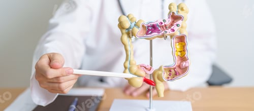 Preview: Doctor with human Colon anatomy model. Colonic disease