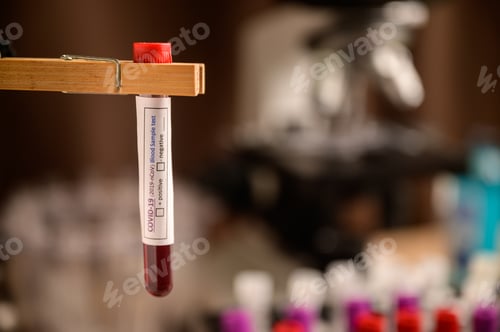 Preview: Blood sample test tube for COVID-19 in Laboratory