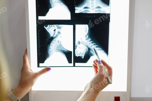 Preview: Close up view of doctor hand with pen pointing at x-ray image of neck