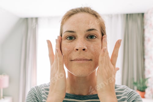 Preview: A freckled woman applies cream to her face, looking at the camera as if in a mirror.