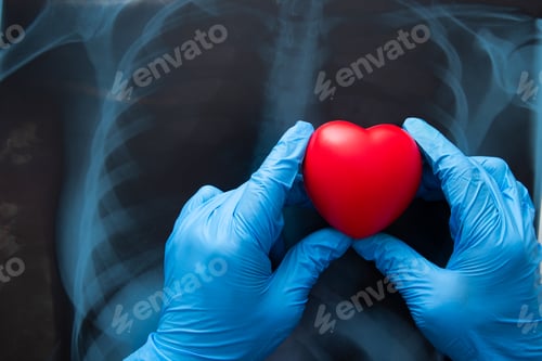 Preview: Red heart on x ray chest.