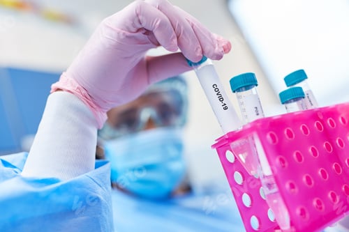Preview: Medical Professionals In The Laboratory With Smears And Saliva Samples For Covid-19 And Coronavirus