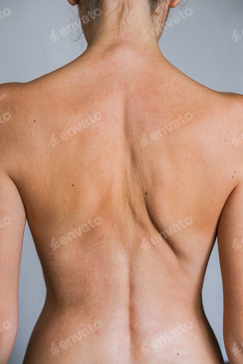Preview: Psoriasis Skin Disease Is A Dermatic Problem, Red Allergic Skin Rash.