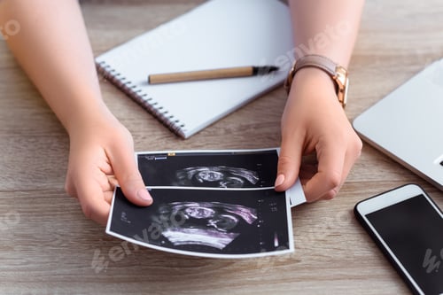 Preview: cropped view of female hands holding ultrasound scan of unborn baby