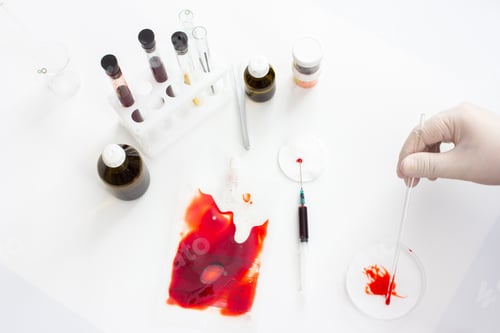 Preview: Coronavirus vaccine development. Laboratory for research of blood of patients with the virus