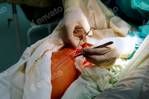 Preview: Doctor in the operating room for surgical leg surgery clinic, operation of varicose veins