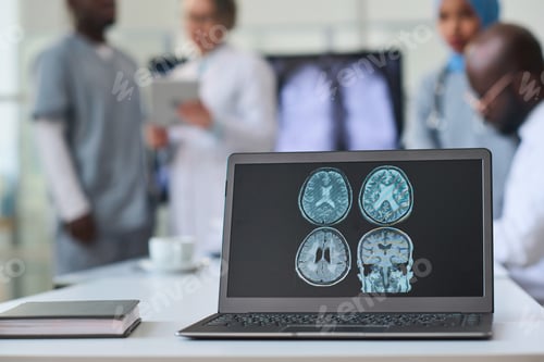 Preview: X-ray image of brain on laptop