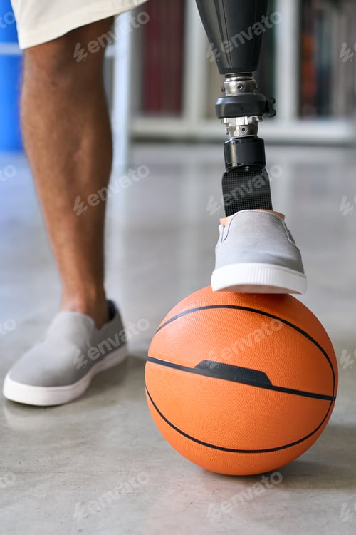 Preview: Amputee man with prosthetic leg prosthesis posing with basketball ball.
