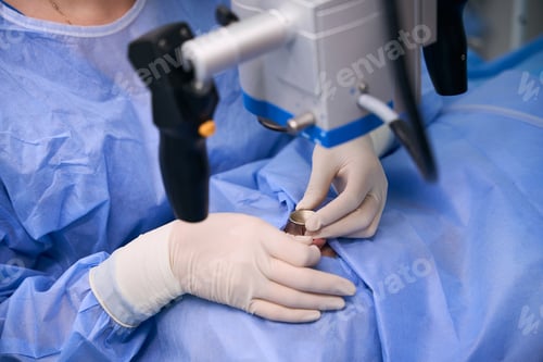 Preview: Surgeon uses special optical equipment, during the operation
