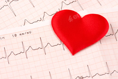 Preview: Cardiogram chart with red heart