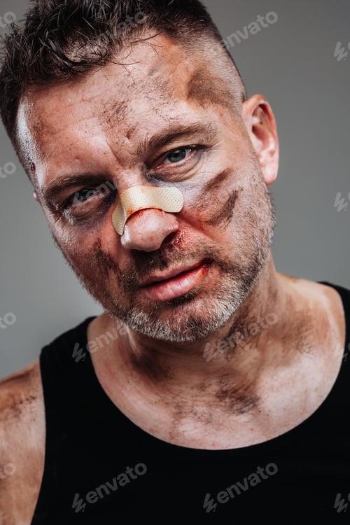 Preview: a battered man in a black T shirt who looks like a drug addict and a drunk stands against a gray