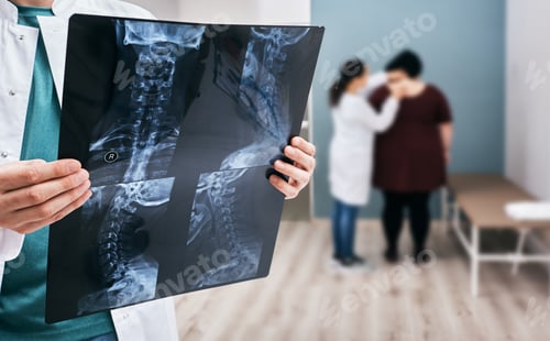 Preview: Doctor holds an x-ray of a cervical spine over background osteopath check-up overweight woman's