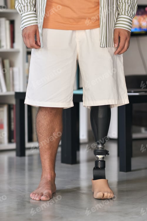 Preview: Amputee man with above knee leg prosthesis standing on feet, close up.