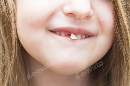 Preview: portrait of a little child girl moving her milk front tooth with her tongue in open mouth.