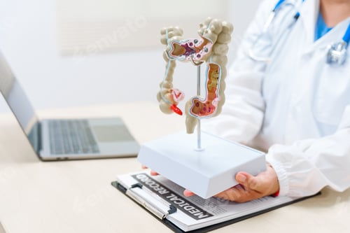 Preview: A doctor holds a human colon anatomy model, demonstrating the digestive system