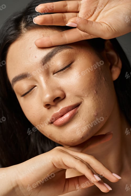 Preview: pleased young asian woman with acne prone skin and closed eyes on grey background, skin issues