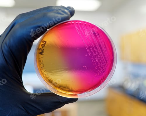 Preview: Salmonella growing on brilliant green sulfa agar