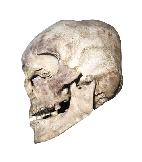 Preview: old human skull