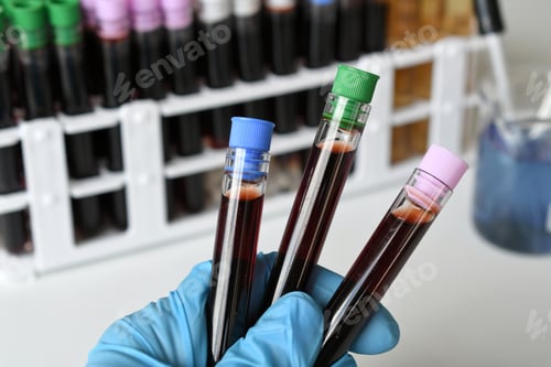 Preview: A medical worker lab technician holding vials of blood for testing