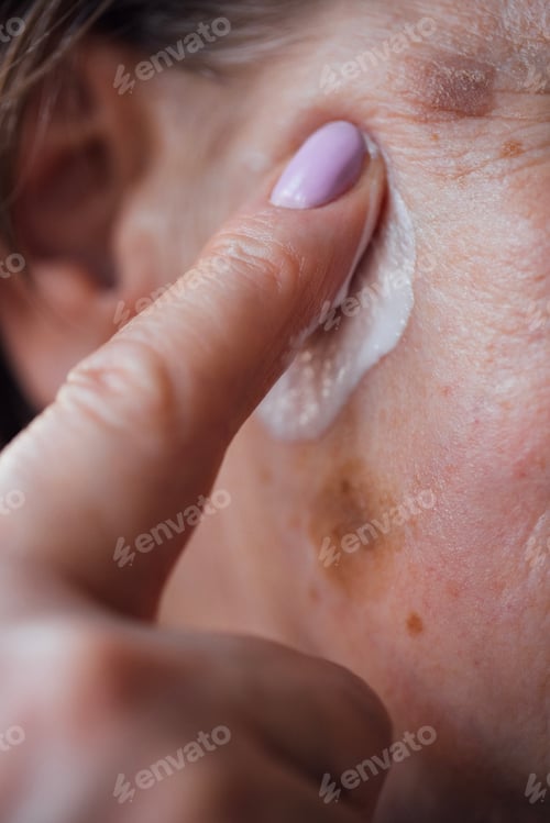 Preview: Close-up of an elderly woman face with moisturizer on her cheek